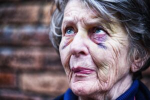 CAMBRIDGE NURSING HOME ABUSE