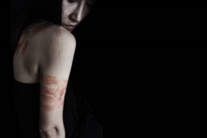 JUSTICE AND COMPENSATION FOR YOUR SEXUAL ASSAULT INJURIES IN BOSTON